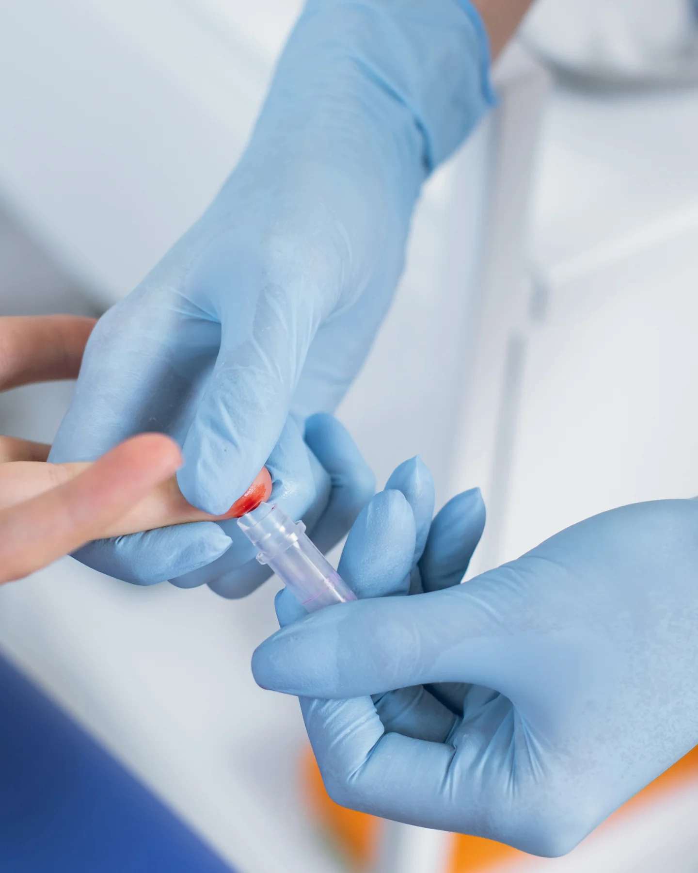 Blood Alcohol Biomarker Testing