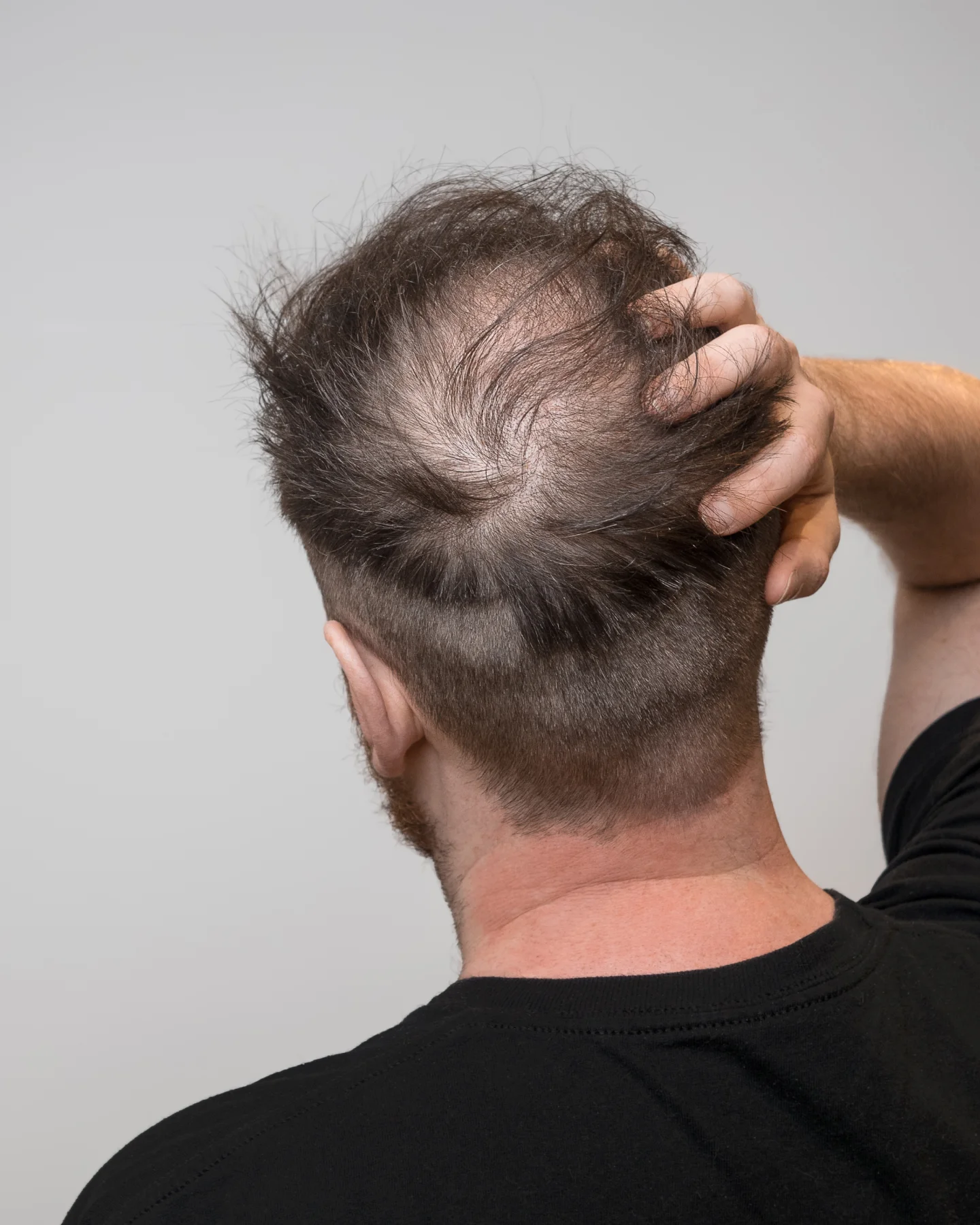 Hair Alcohol Testing