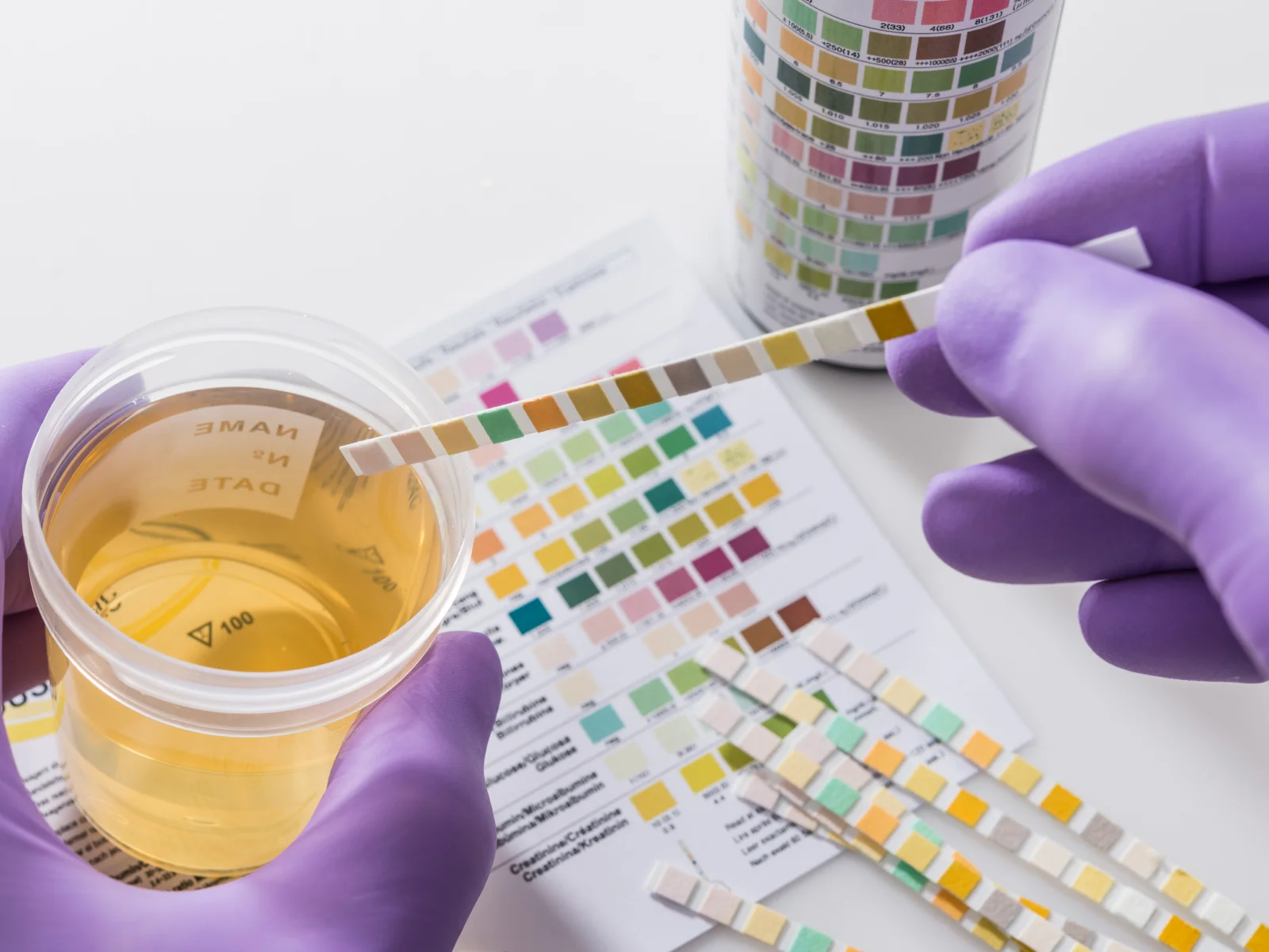 Do Urine and Oral Fluid Drug Testing Have a Role in Child Law Proceedings?