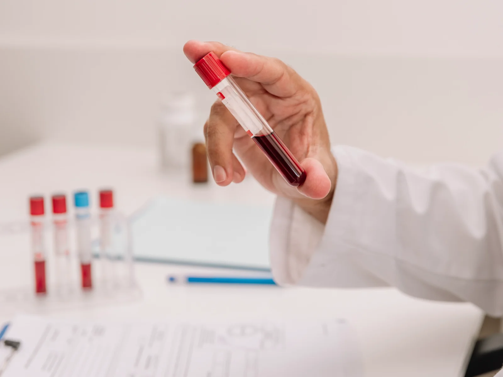 What Is the CDT Blood Test for Alcohol?